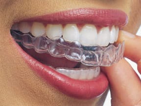 Johns Creek Invisalign